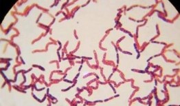 俄罗斯细菌爆料视频大全,病毒爆料视频大全深度解析